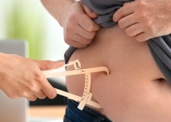 Dúvidas mais comuns sobre cirurgia bariátrica