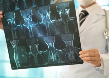 gordura-e-massa-muscular-podem-prolongar-vida-de-pacientes-com-cancer