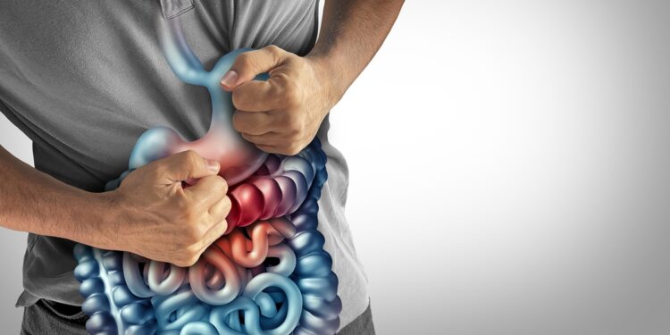 cientistas-desvendam-misterio-sobre-a-doenca-de-crohn-com-ajuda-da-ia