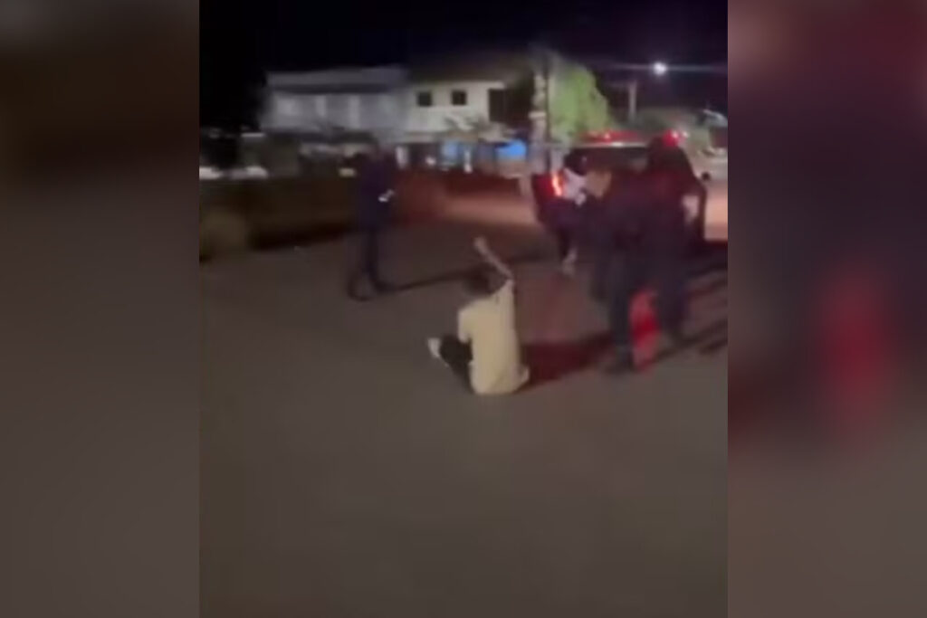 jovem-tem-traumatismo-craniano-apos-ser-golpeado-com-cassetete-por-gcm