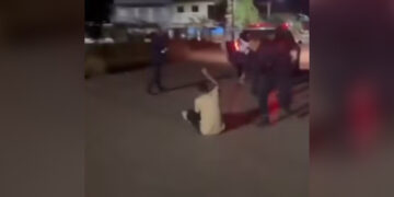 jovem-tem-traumatismo-craniano-apos-ser-golpeado-com-cassetete-por-gcm