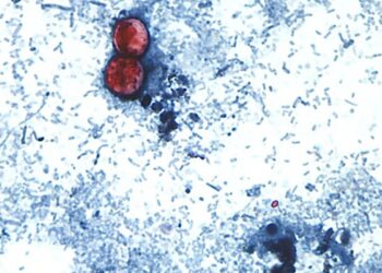 cdc-investiga-casos-de-parasita-que-pode-contaminar-alimentos-frescos