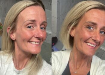 bronzeado-sem-sol:-peptideo-ilegal-ganha-espaco-nas-redes-sociais
