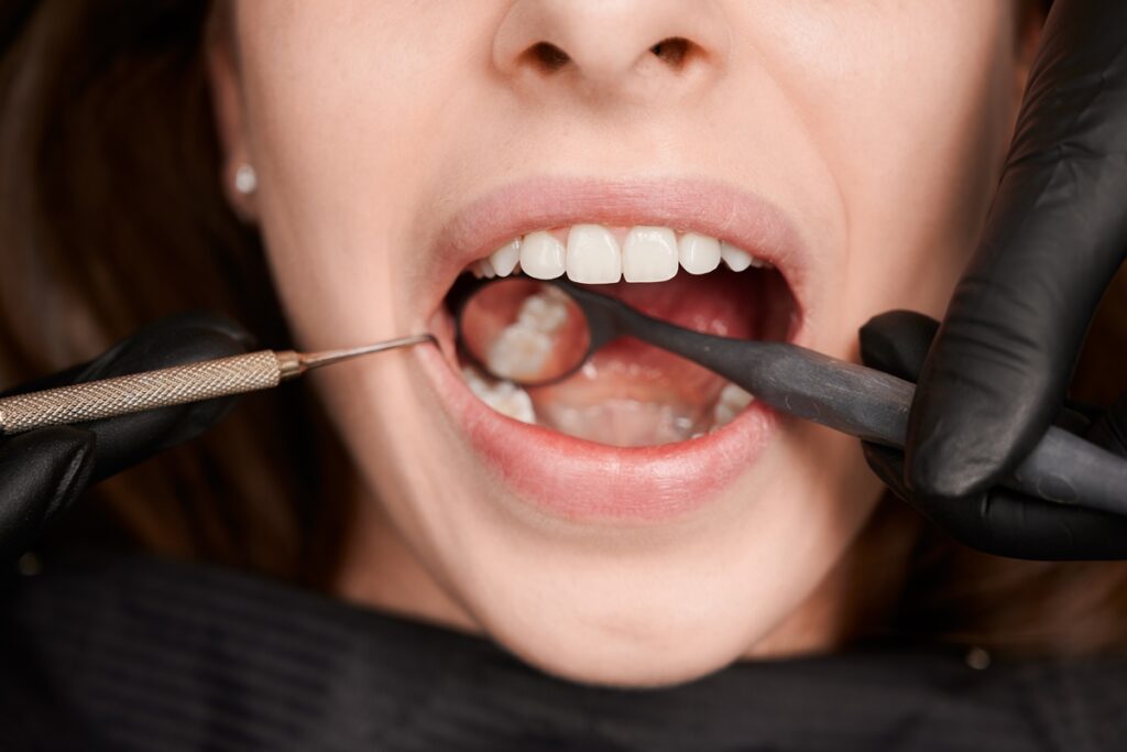 cientistas-criam-gel-que-pode-regenerar-dentes-deteriorados-pela-carie