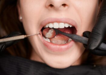 cientistas-criam-gel-que-pode-regenerar-dentes-deteriorados-pela-carie