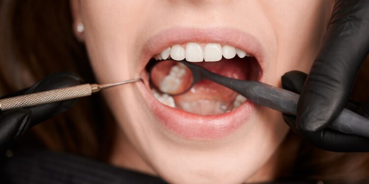 cientistas-criam-gel-que-pode-regenerar-dentes-deteriorados-pela-carie