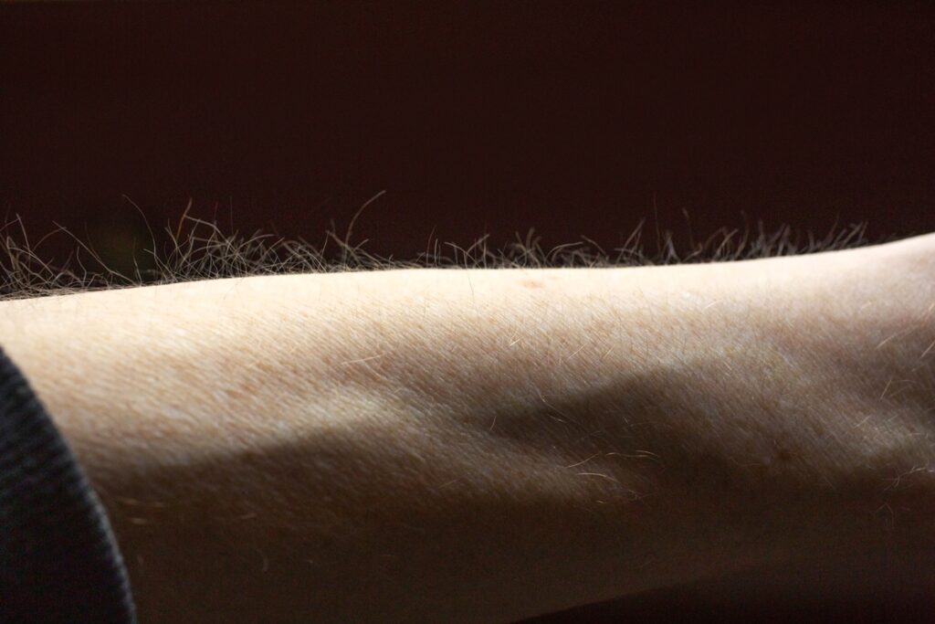 pelos-da-pele-podem-ajudar-o-corpo-a-detectar-coceira,-sugere-estudo