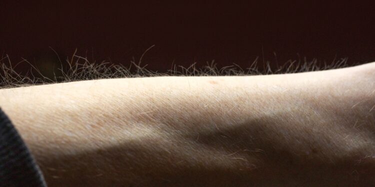 pelos-da-pele-podem-ajudar-o-corpo-a-detectar-coceira,-sugere-estudo
