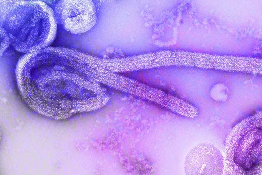 uganda-e-declarada-livre-do-ebola-enquanto-surto-segue-no-congo