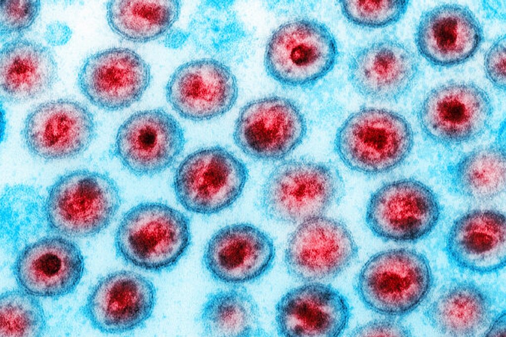 terapia-em-recem-nascidos-elimina-hiv-em-testes-com-primatas