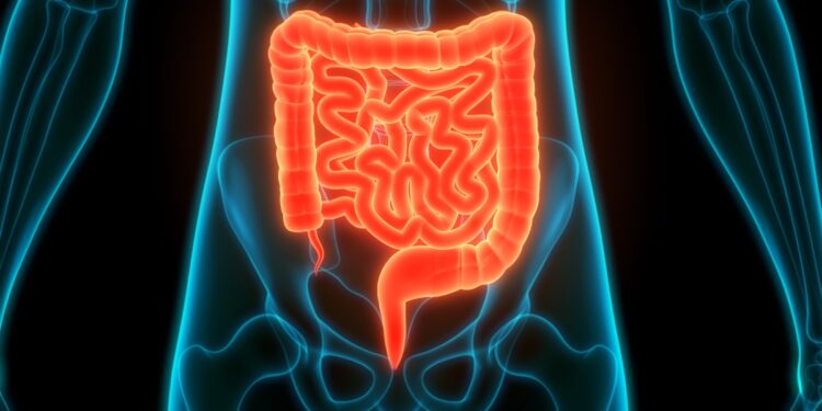 sus-passa-a-oferecer-teste-de-fezes-para-rastrear-cancer-de-intestino