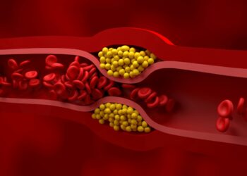 tratamento-de-colesterol-pode-remover-pfas-e-microplasticos-do-sangue