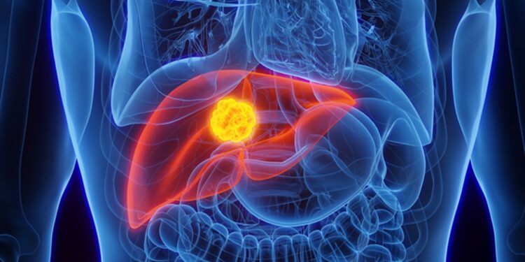 novo-exame-de-dna-pode-identificar-cancer-e-doenca-hepatica-no-inicio