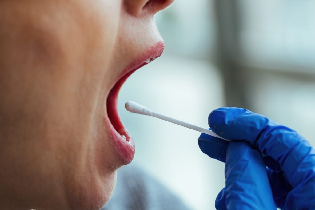 analise-da-saliva-pode-identificar-sinal-ligado-ao-cancer-colorretal