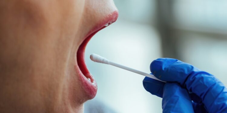analise-da-saliva-pode-identificar-sinal-ligado-ao-cancer-colorretal