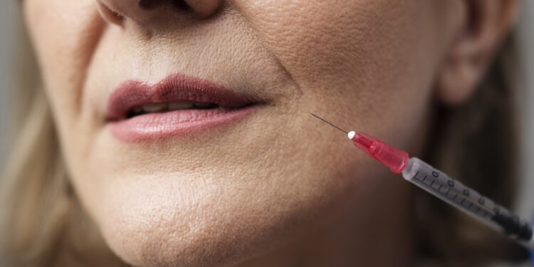 anvisa-proibe-lotes-de-sculptra-apos-fabricante-apontar-falsificacao
