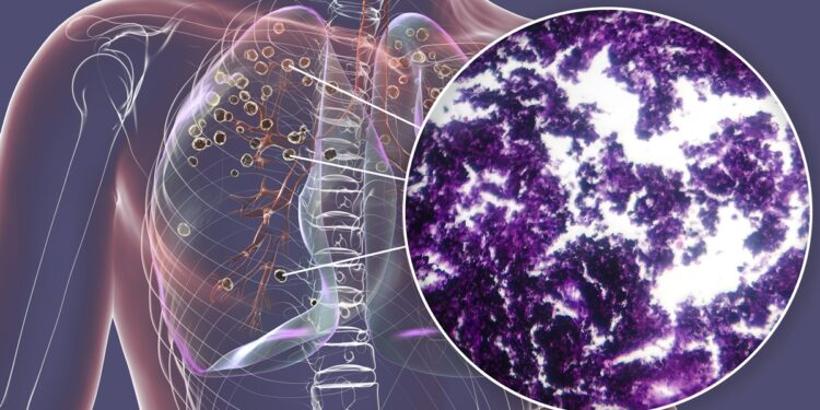 tosse-persistente-pode-ser-sintoma-de-cancer-de-pulmao,-alertam-medicos