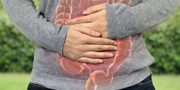 cancer-de-intestino-antes-dos-50-tem-tumor-diferente-e-maior-sobrevida