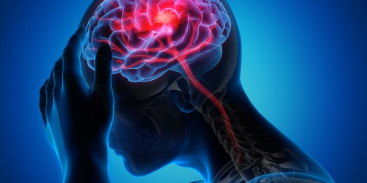 novo-tratamento-injetavel-pode-ajudar-o-cerebro-a-se-recuperar-apos-avc