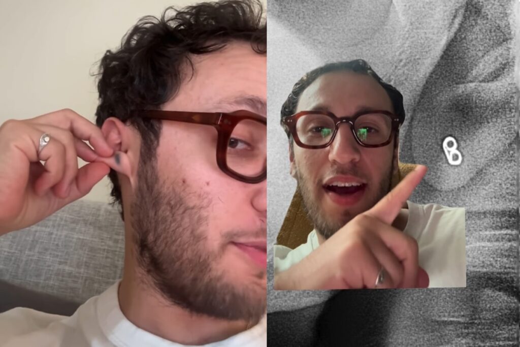 homem-descobre-depois-de-20-anos-que-mancha-na-orelha-era-tarraxa-de-brinco
