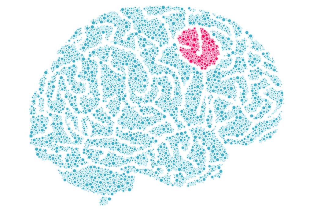 novo-teste-promete-fazer-diagnostico-de-tumor-cerebral-cair-para-duas-horas
