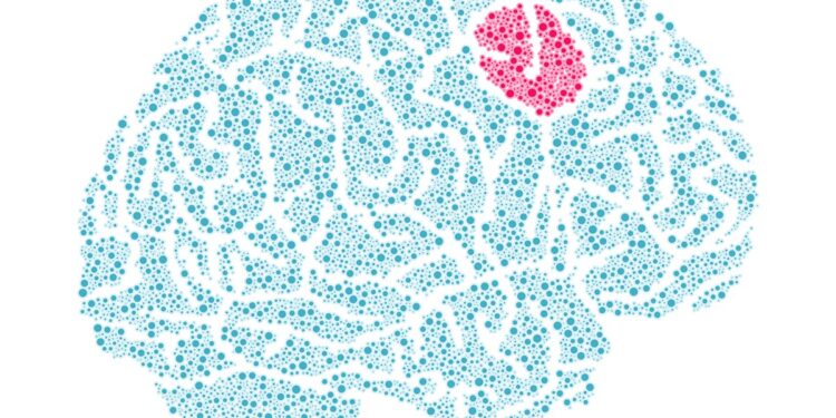 novo-teste-promete-fazer-diagnostico-de-tumor-cerebral-cair-para-duas-horas