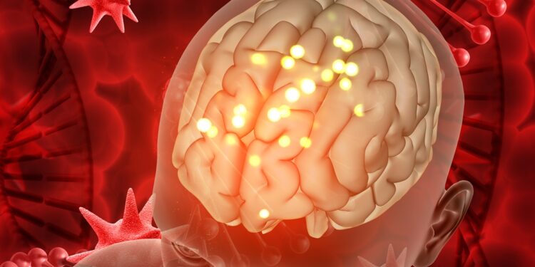 cancer-cria-especie-de-“ninho”-enquanto-cresce-no-cerebro,-aponta-estudo