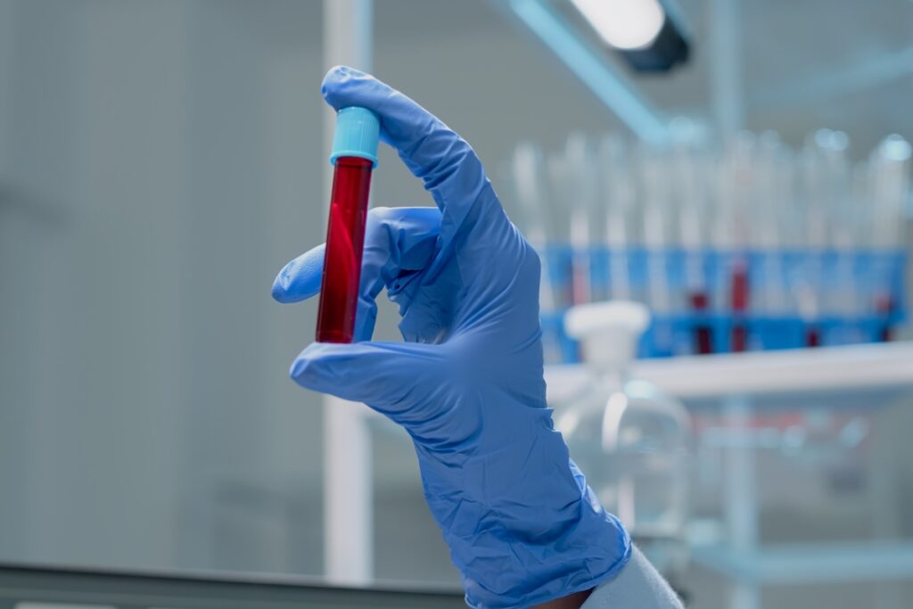 novo-exame-de-sangue-que-detecta-mais-de-50-tipos-de-cancer-chega-ao-brasil