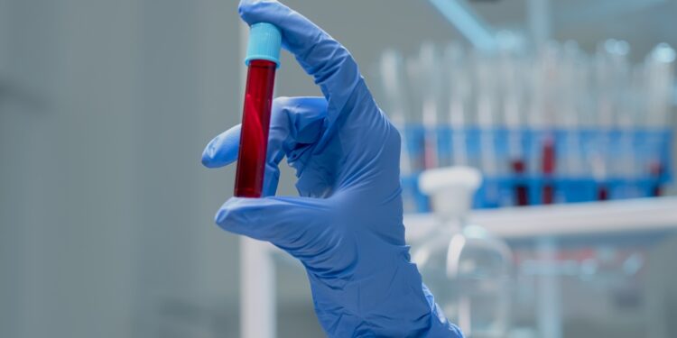 novo-exame-de-sangue-que-detecta-mais-de-50-tipos-de-cancer-chega-ao-brasil