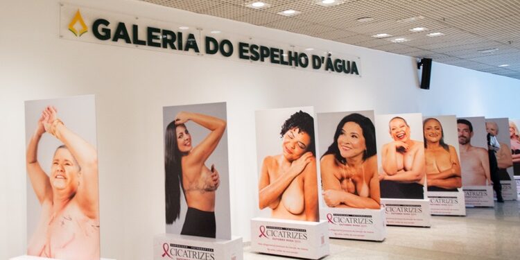 cldf-apresenta-exposicao-fotografica-“cicatrizes”,-que-alerta-sobre-o-cancer-de-mama