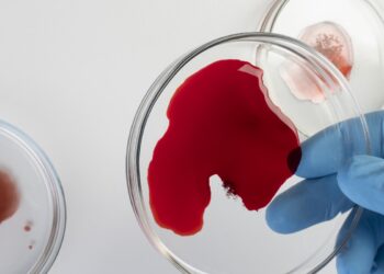 jejum-antes-do-exame-de-sangue-pode-nao-fazer-diferenca,-sugere-estudo