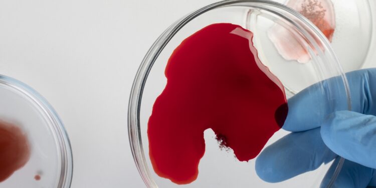 jejum-antes-do-exame-de-sangue-pode-nao-fazer-diferenca,-sugere-estudo