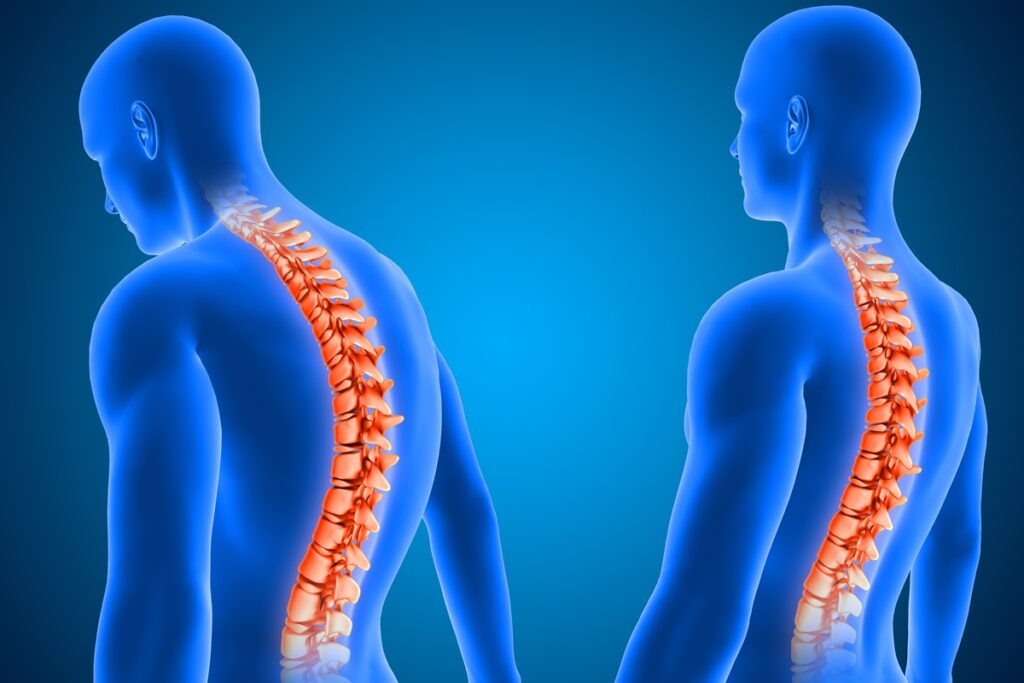 medicos-afirmam-ter-feito-primeiro-transplante-de-medula-espinhal-na-russia