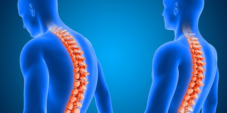 medicos-afirmam-ter-feito-primeiro-transplante-de-medula-espinhal-na-russia