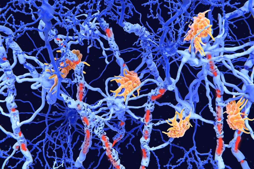 estudo-mostra-avanco-em-terapias-inovadoras-para-doencas-neuroimunologicas